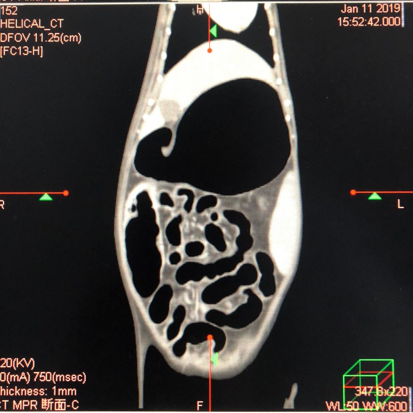 写真 2019-03-17 11 25 57